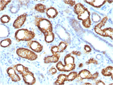 Anti-AMACR antibody [AMACR/3931R] used in IHC (Paraffin sections) (IHC-P). GTX02587