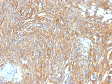 Anti-TMEM16A antibody [DG1/2564R] used in IHC (Paraffin sections) (IHC-P). GTX02588