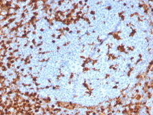 Anti-Annexin A1 antibody [ANXA1/3869R] used in IHC (Paraffin sections) (IHC-P). GTX02590