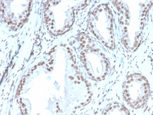 Anti-ATRX antibody [rATRX/3446] used in IHC (Paraffin sections) (IHC-P). GTX02592