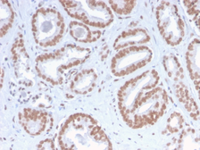 Anti-ATRX antibody [ATRX/2900R] used in IHC (Paraffin sections) (IHC-P). GTX02593