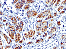 Anti-Caldesmon antibody [CALD1/1424R] used in IHC (Paraffin sections) (IHC-P). GTX02598