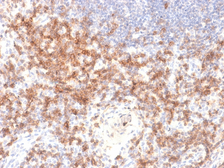 Anti-CD27 antibody [LPFS2/2034R] used in IHC (Paraffin sections) (IHC-P). GTX02601