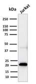Anti-CD3 epsilon antibody [C3e/2858R] used in Western Blot (WB). GTX02604