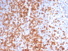 Anti-CD3 epsilon antibody [C3e/3125R] used in IHC (Paraffin sections) (IHC-P). GTX02605