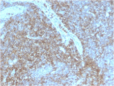 Anti-CD44 antibody [HCAM/2875R] used in IHC (Paraffin sections) (IHC-P). GTX02606