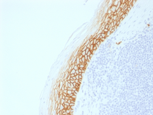 Anti-CD44 antibody [CD44v9/2344R] used in IHC (Paraffin sections) (IHC-P). GTX02607
