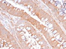 Anti-CD59 antibody [MACIF/2867R] used in IHC (Paraffin sections) (IHC-P). GTX02608
