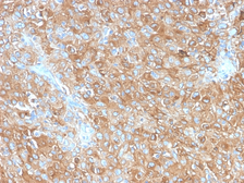 Anti-CD63 antibody [LAMP3/2990R] used in IHC (Paraffin sections) (IHC-P). GTX02610