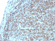 Anti-CD74 antibody [CLIP/3127R] used in IHC (Paraffin sections) (IHC-P). GTX02612