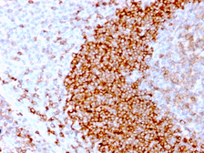 Anti-CD79b antibody [IGB/3170R] used in IHC (Paraffin sections) (IHC-P). GTX02613