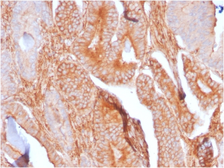 Anti-CD81 antibody [C81/2885R] used in IHC (Paraffin sections) (IHC-P). GTX02614