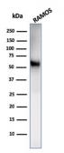 Anti-CD86 antibody [C86/2160R] used in Western Blot (WB). GTX02615