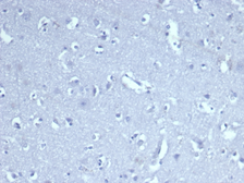 Anti-CD8 alpha antibody [CD8/4391R] used in IHC (Paraffin sections) (IHC-P). GTX02616