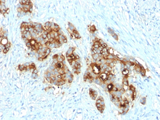 Anti-CD66e antibody [C66/2055R] used in IHC (Paraffin sections) (IHC-P). GTX02621