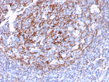 Anti-CD21 antibody [CR2/3124R] used in IHC (Paraffin sections) (IHC-P). GTX02624