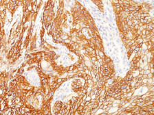 Anti-EGFR antibody [GFR/2600R] used in IHC (Paraffin sections) (IHC-P). GTX02628