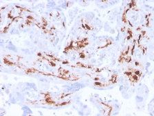 Anti-Factor XIIIa antibody [F13A1/3772R] used in IHC (Paraffin sections) (IHC-P). GTX02636