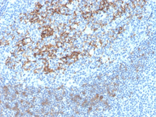 Anti-CD23 antibody [FCER2/4395R] used in IHC (Paraffin sections) (IHC-P). GTX02637