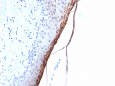 Anti-Filaggrin antibody [FLG/1957R] used in IHC (Paraffin sections) (IHC-P). GTX02638