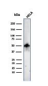 Anti-FOXA1 antibody [FOXA1/2230R] used in Western Blot (WB). GTX02640