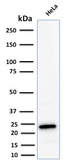 Anti-Ferritin Light Chain antibody [FTL/2338R] used in Western Blot (WB). GTX02641