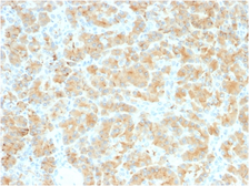 Anti-GP2 antibody [GP2/2569R] used in IHC (Paraffin sections) (IHC-P). GTX02645