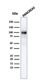 Anti-GP2 antibody [GP2/3134R] used in Western Blot (WB). GTX02646