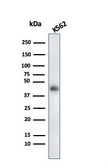 Anti-Glycophorin A antibody [rGYPA/280] used in Western Blot (WB). GTX02647