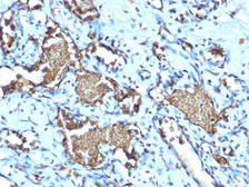 Anti-Glycophorin A antibody [GYPA/1725R] used in IHC (Paraffin sections) (IHC-P). GTX02648
