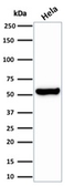 Anti-HSP60 antibody [HSPD1/2206R] used in Western Blot (WB). GTX02649
