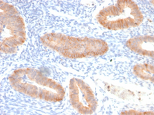 Anti-IL10 antibody [IL10/2651R] used in IHC (Paraffin sections) (IHC-P). GTX02650