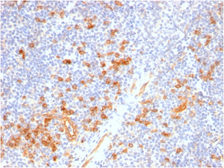 Anti-IL3 Receptor alpha antibody [IL3RA/2947R] used in IHC (Paraffin sections) (IHC-P). GTX02651