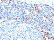 Anti-Integrin alpha E antibody [ITGAE/3904R] used in IHC (Paraffin sections) (IHC-P). GTX02653