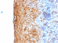 Anti-Involucrin antibody [IVRN/2113R] used in IHC (Paraffin sections) (IHC-P). GTX02654