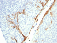 Anti-Cytokeratin 16 antibody [rKRT16/1714] used in IHC (Paraffin sections) (IHC-P). GTX02655