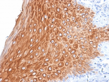 Anti-Cytokeratin 16 antibody [KRT16/2043R] used in IHC (Paraffin sections) (IHC-P). GTX02656