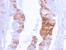 Anti-Cytokeratin 20 antibody [KRT20/3129R] used in IHC (Paraffin sections) (IHC-P). GTX02660