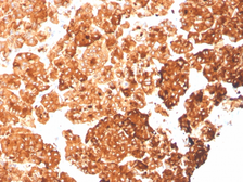 Anti-Cytokeratin 6a antibody [rKRT6A/2100] used in IHC (Paraffin sections) (IHC-P). GTX02661