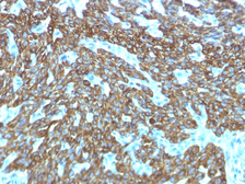 Anti-Cytokeratin 2 antibody [KRTH/1576R] used in IHC (Paraffin sections) (IHC-P). GTX02663