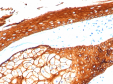 Anti-Cytokeratin 2 antibody [KRTH/4392R] used in IHC (Paraffin sections) (IHC-P). GTX02665