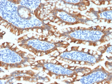Anti-Cytokeratin 8 antibody [KRT8/2174R] used in IHC (Paraffin sections) (IHC-P). GTX02669