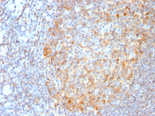 Anti-MALT1 antibody [MT1/3159R] used in IHC (Paraffin sections) (IHC-P). GTX02671