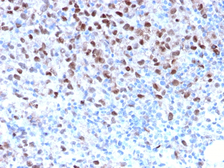 Anti-MITF antibody [MITF/2987R] used in IHC (Paraffin sections) (IHC-P). GTX02674