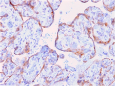 Anti-MMP3 antibody [rMMP3/1730] used in IHC (Paraffin sections) (IHC-P). GTX02675