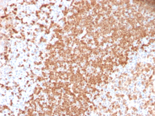 Anti-Mesothelin antibody [TCL1/2747R] used in IHC (Paraffin sections) (IHC-P). GTX02676