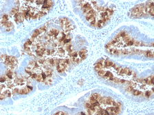 Anti-MUC1 antibody [MUC1/2818R] used in IHC (Paraffin sections) (IHC-P). GTX02678