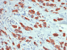 Anti-MUC1 antibody [MUC1/1887R] used in IHC (Paraffin sections) (IHC-P). GTX02679
