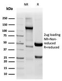 Anti-Napsin A antibody [NAPSA/4400R] used in Protein Array (Protein Array). GTX02684