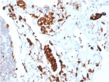 Anti-Napsin A antibody [NAPSA/1865R] used in IHC (Paraffin sections) (IHC-P). GTX02685
